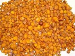 Gallstones